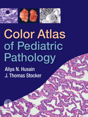 cover image of Color Atlas of Pediatric Pathology